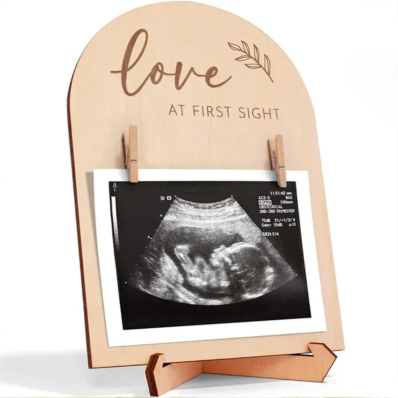 Baby Ultrasound Photo Frame - Image 8